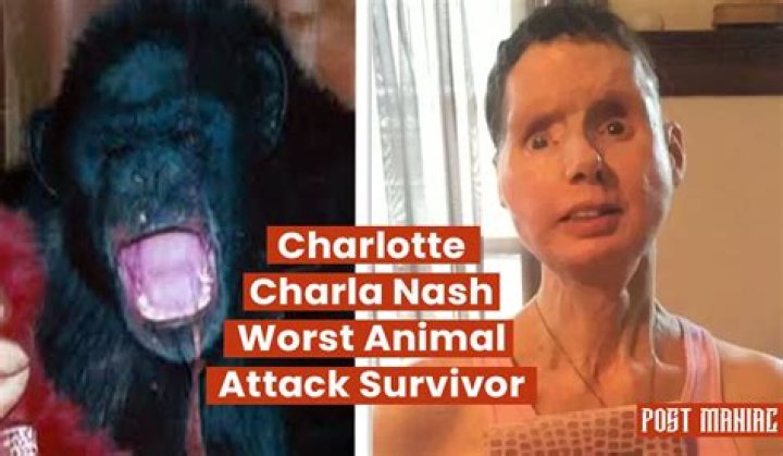 Charla Nash: New Face of Chimpanzee Attack Victim Revealed
