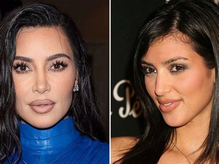 Decoding Kim Kardashian's Plastic Surgery Timeline: Fact vs. Fiction