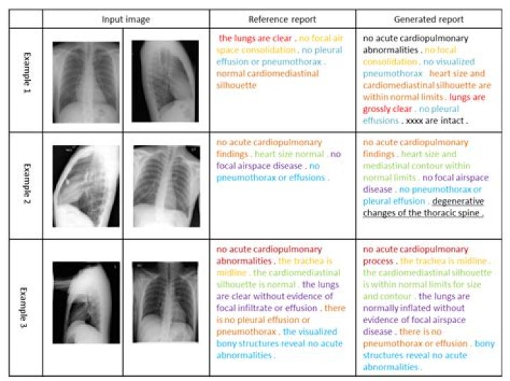 Does A Chest X-Ray Help Diagnose Heart Failure, And What Else Might It Tell My Doctor?