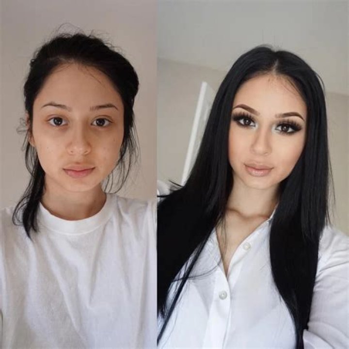 Jenny 69 Before and After Surgery, Look At The Images Of Jenny 69 Before And After Surgery