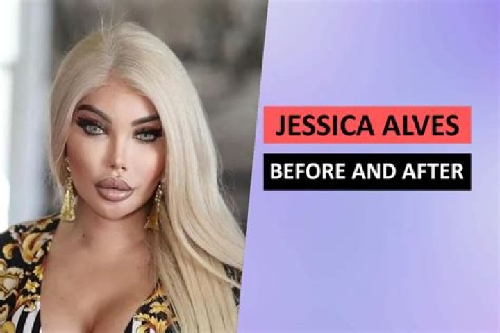 Jessica Alves Before And After, Jessica Alves Age, Net Worth, Instagram