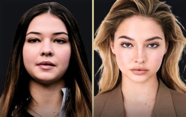 Madelyn Cline Before And After Surgery, Evolution of Her Appearance
