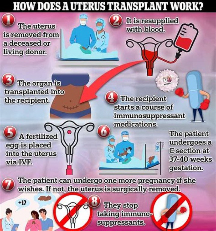 What You Need to Know About Uterus Transplants