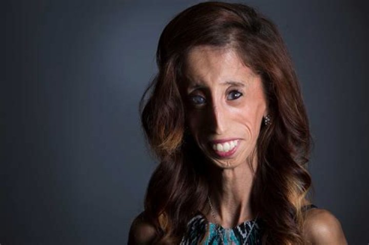 Who Is The Ugliest Person In The World?, Pictures, List