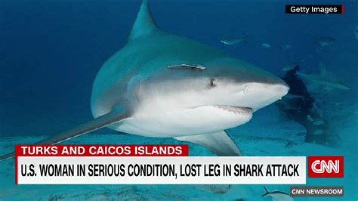 Woman who lost a leg in shark attack describes how she's recovered 1 year later